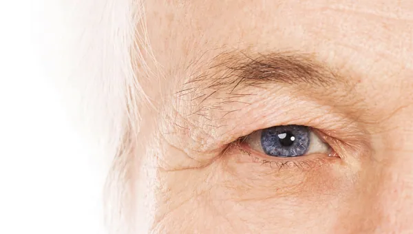 Lézeres szemműtét